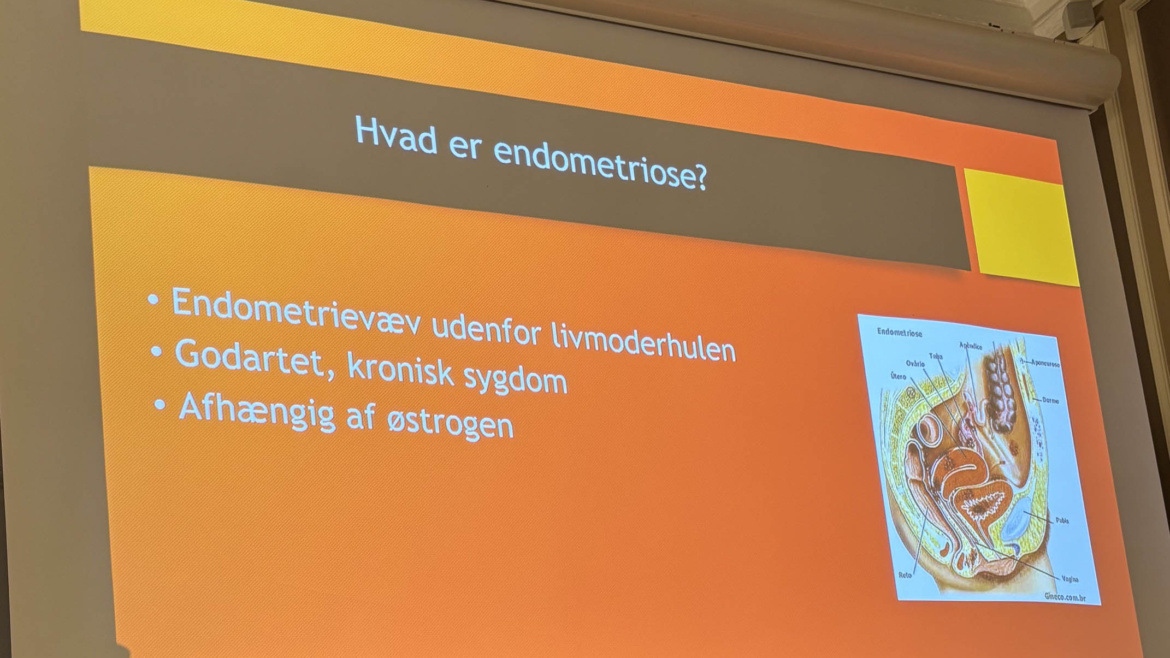 Hvad er Endometriose